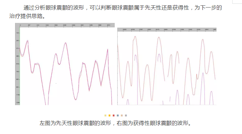 杨东生教授：多方面解析眼球震颤